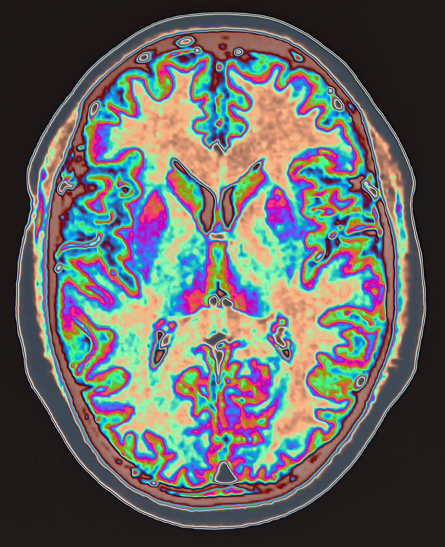 FISIOSOFIA E NEUROPLASTICITÀ COSCIENZIALE